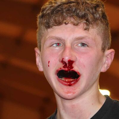 Bloodied But Unbowed that's Jay Snoddon when he faced Poland's Phili Nowak in Switzerland